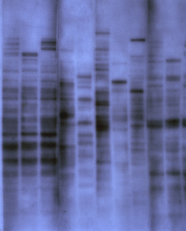 The first genetic fingerprint, 1984.