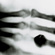 Roentgen's X-ray, 1895.